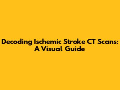 Decoding Ischemic Stroke CT Scans: A Visual Guide