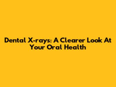 Dental X-rays: A Clearer Look At Your Oral Health