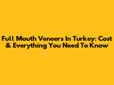 Full Mouth Veneers In Turkey: Cost & Everything You Need To Know