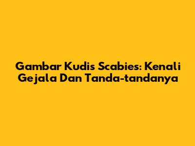 Gambar Kudis Scabies: Kenali Gejala Dan Tanda-tandanya