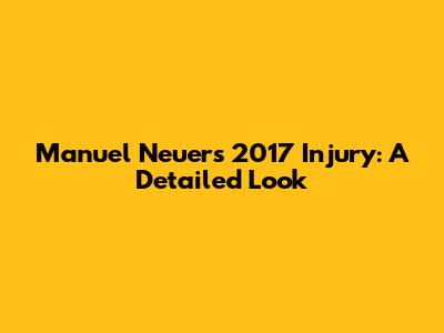Manuel Neuer's 2017 Injury: A Detailed Look