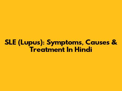 SLE (Lupus): Symptoms, Causes & Treatment In Hindi