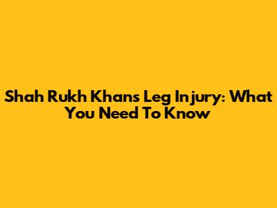 Shah Rukh Khan's Leg Injury: What You Need To Know